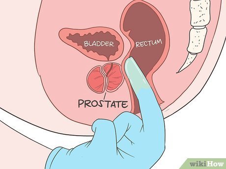 v4-460px-Locate-Your-Prostate-Step-9-Version-2.jpg